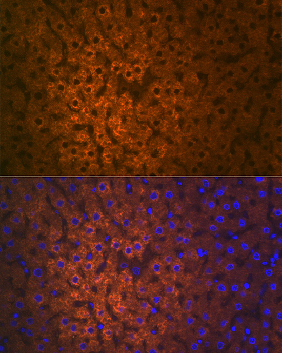 FMO3 Rabbit monoclonal antibody