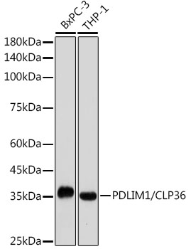 PDLIM1/CLP36 Rabbit mAb