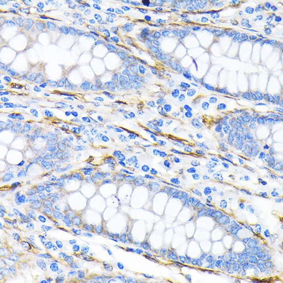 LPP Rabbit monoclonal antibody
