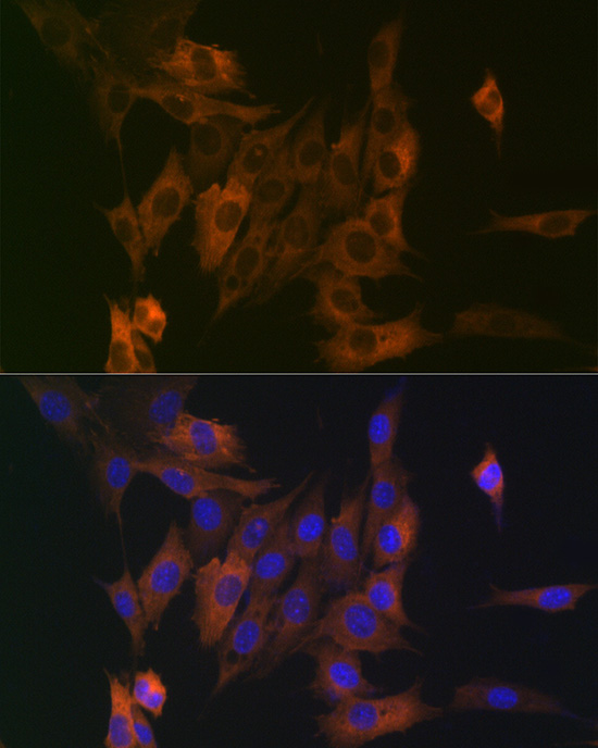 LPP Rabbit monoclonal antibody