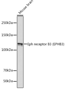 Eph receptor B3 (EPHB3) Rabbit monoclonal antibody