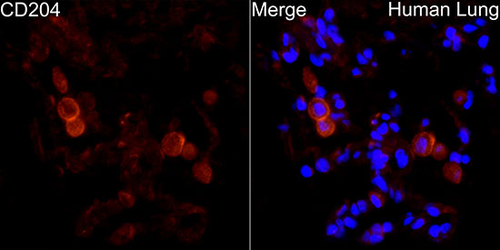 MSR1 Rabbit polyclonal antibody