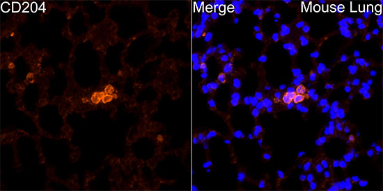 MSR1 Rabbit polyclonal antibody