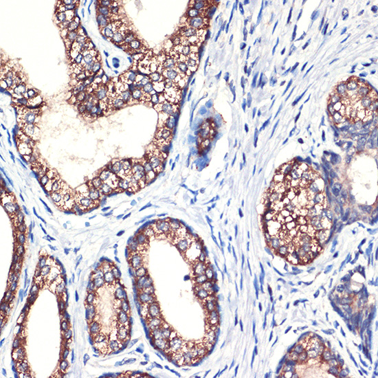 Arginase 2 (ARG2) Rabbit monoclonal antibody