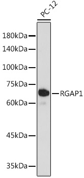 RGAP1 Rabbit monoclonal antibody