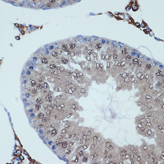RanBP9 Rabbit monoclonal antibody