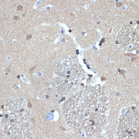 RanBP9 Rabbit monoclonal antibody