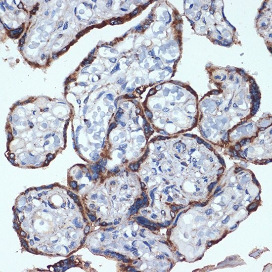 P4HB Rabbit monoclonal antibody