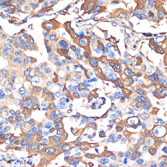 VPS28 Rabbit monoclonal antibody