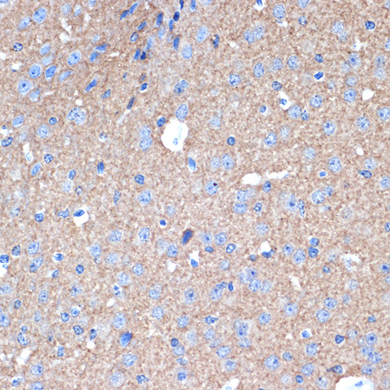 STX1A Rabbit monoclonal antibody