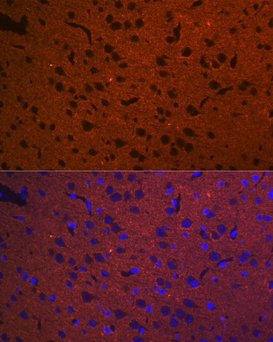 STX1A Rabbit monoclonal antibody