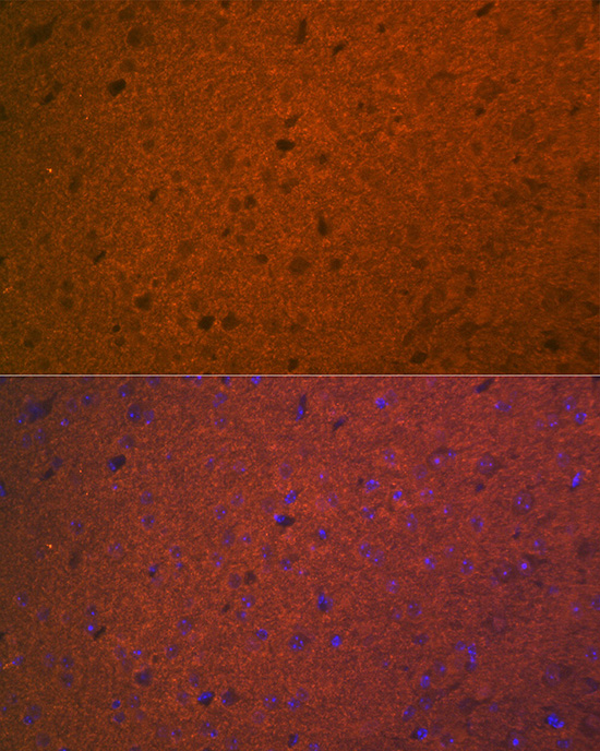 STX1A Rabbit monoclonal antibody