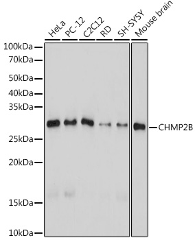 CHMP2B Rabbit monoclonal antibody
