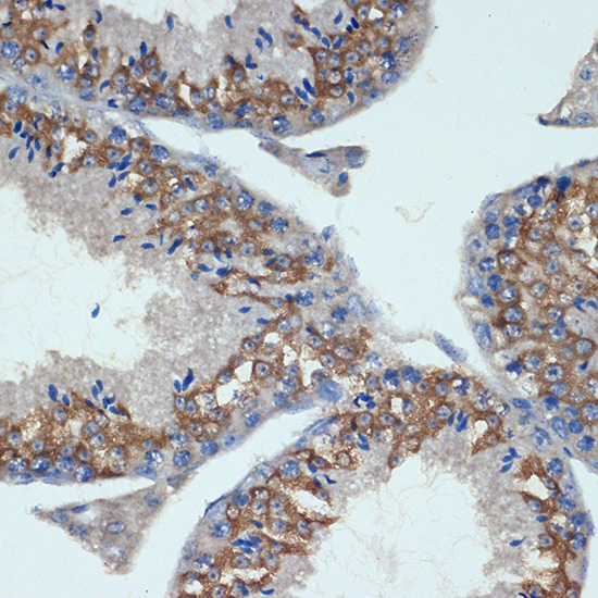 CHMP2B Rabbit monoclonal antibody
