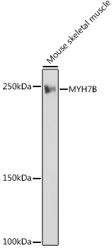 MYH7B Rabbit monoclonal antibody