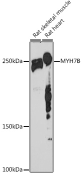 MYH7B Rabbit monoclonal antibody