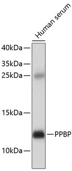 PPBP Rabbit pAb