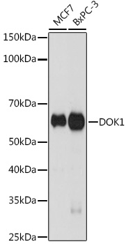 DOK1 Rabbit monoclonal antibody