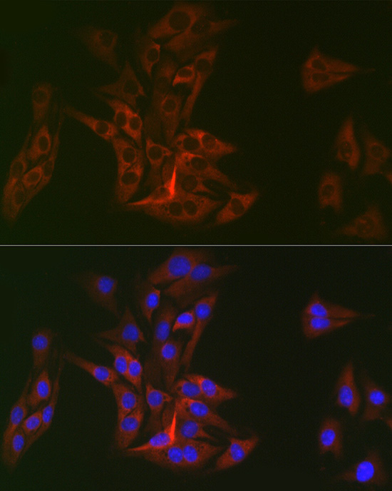 DOK1 Rabbit monoclonal antibody