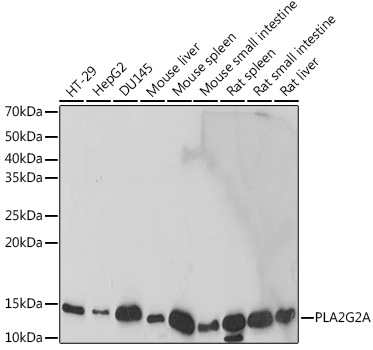 PLA2G2A Rabbit monoclonal antibody