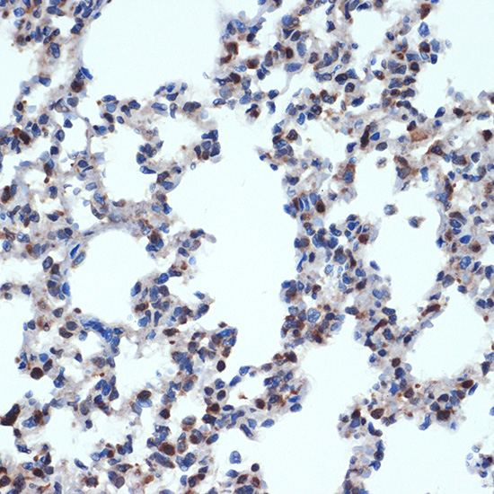 Gemin 2 Rabbit monoclonal antibody