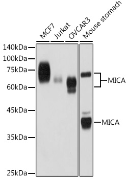 MICA Rabbit monoclonal antibody