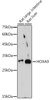 HOXA9 Rabbit monoclonal antibody