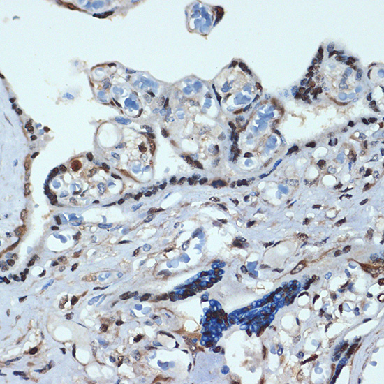HOXA9 Rabbit monoclonal antibody