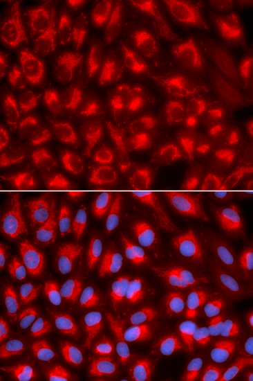 TFAM Rabbit polyclonal antibody