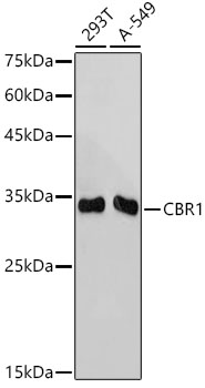 CBR1 Rabbit monoclonal antibody