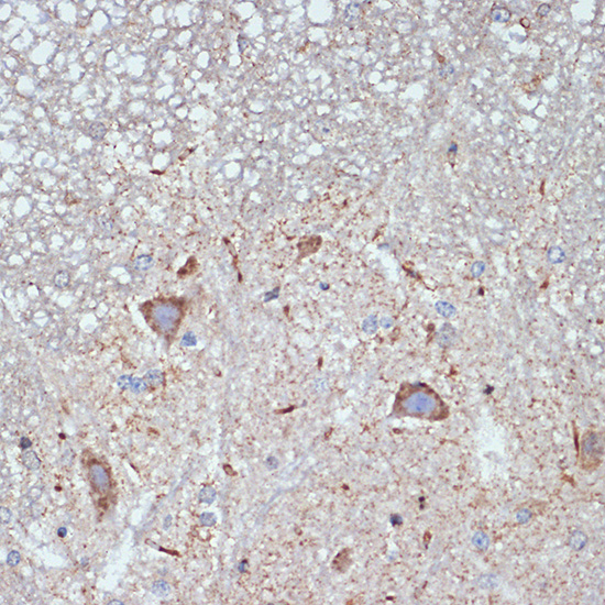CBR1 Rabbit monoclonal antibody