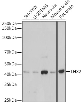 LHX2 Rabbit monoclonal antibody
