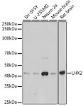 Western blot - LHX2 Rabbit mAb (A19265)