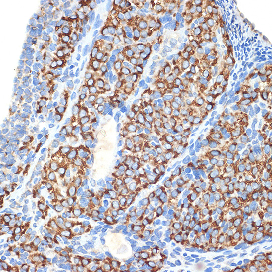 HSD3B1 Rabbit monoclonal antibody