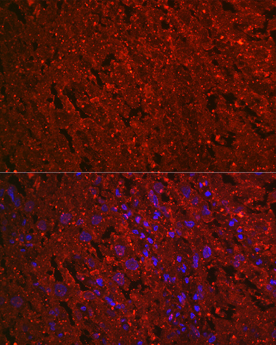 Human EG-VEGF/PK1 Rabbit monoclonal antibody