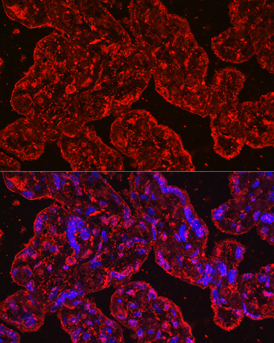 Human EG-VEGF/PK1 Rabbit monoclonal antibody