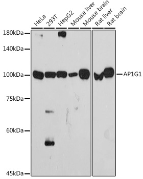 AP1G1 Rabbit monoclonal antibody