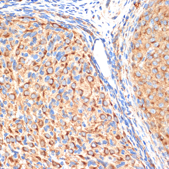 AP1G1 Rabbit monoclonal antibody