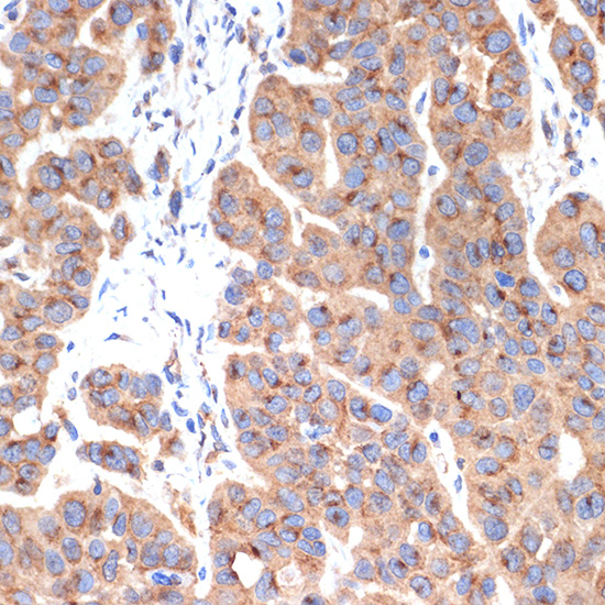 AP1G1 Rabbit monoclonal antibody