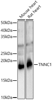 TNNC1 Rabbit polyclonal antibody