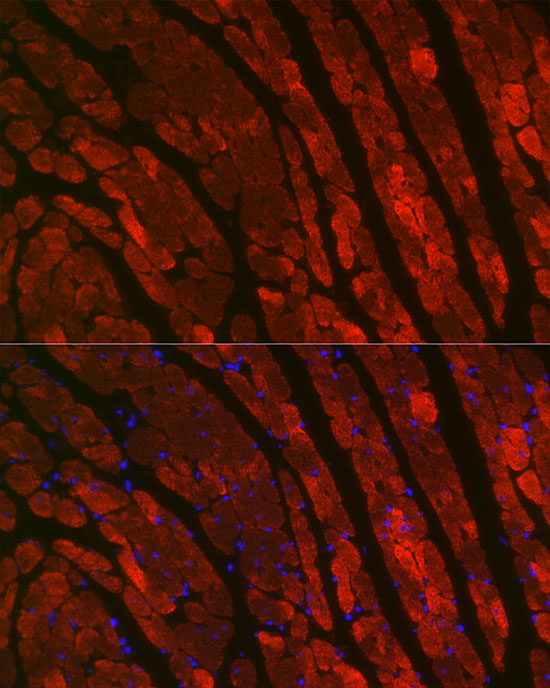 TNNC1 Rabbit polyclonal antibody