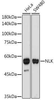 NLK Rabbit monoclonal antibody