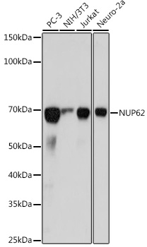 NUP62 Rabbit monoclonal antibody