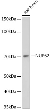 NUP62 Rabbit monoclonal antibody