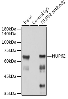 NUP62 Rabbit monoclonal antibody