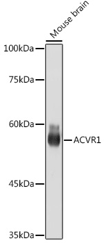 ACVR1 Rabbit monoclonal antibody