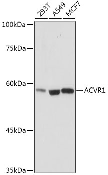 ACVR1 Rabbit monoclonal antibody