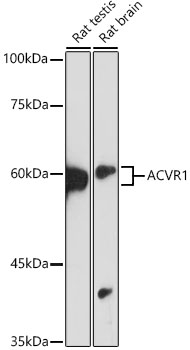 ACVR1 Rabbit monoclonal antibody