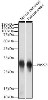 PRSS2 Rabbit monoclonal antibody
