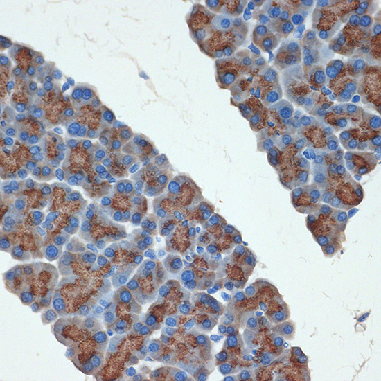 PRSS2 Rabbit monoclonal antibody